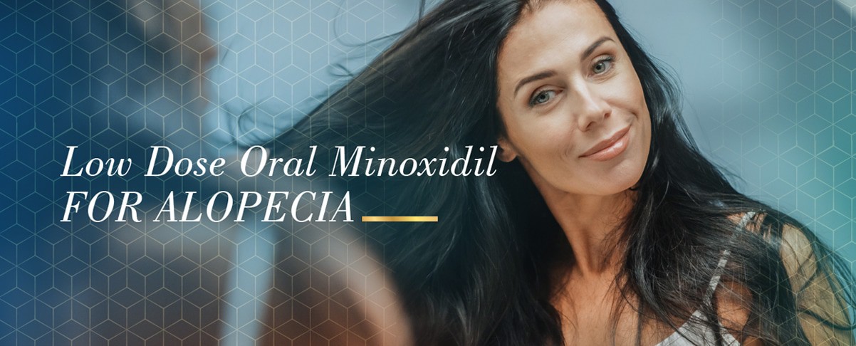Low-Dose Oral Minoxidil (LDOM) for Alopecia: What to Know